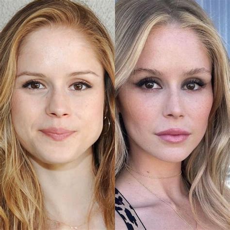 erin moriarty plastic|Starlight Actress Erin Moriartys Plastic Surgery。